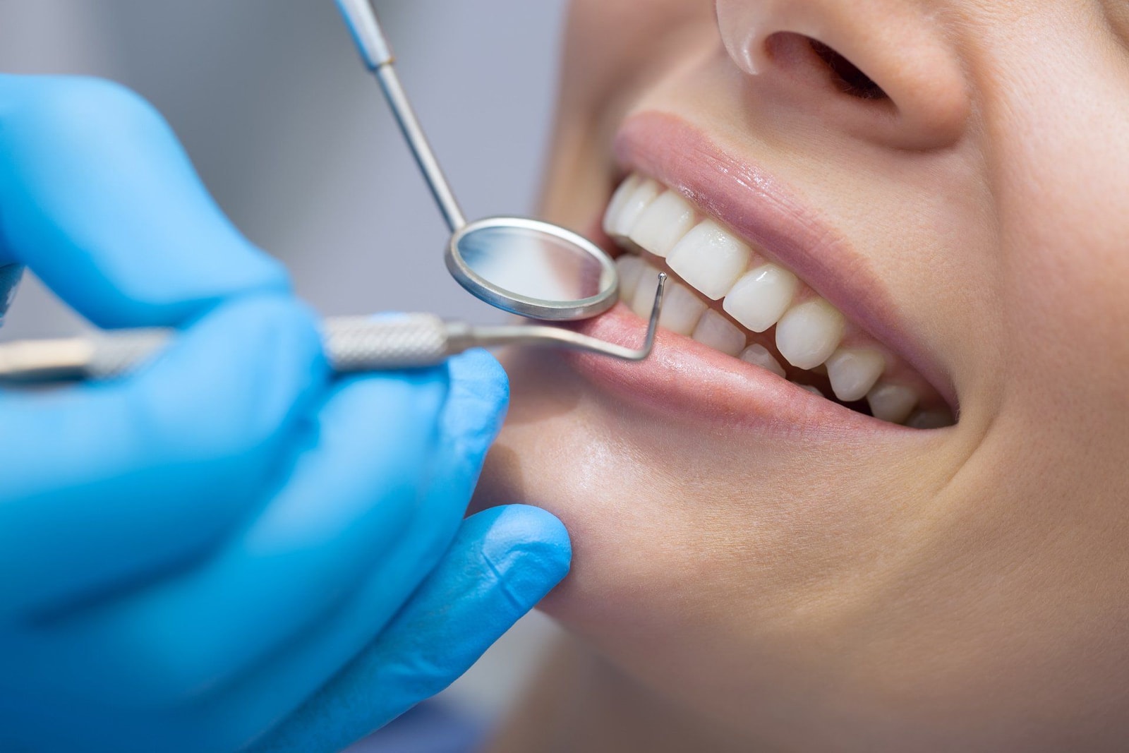 Controllo ravvicinato dei denti con specchietto e sonda