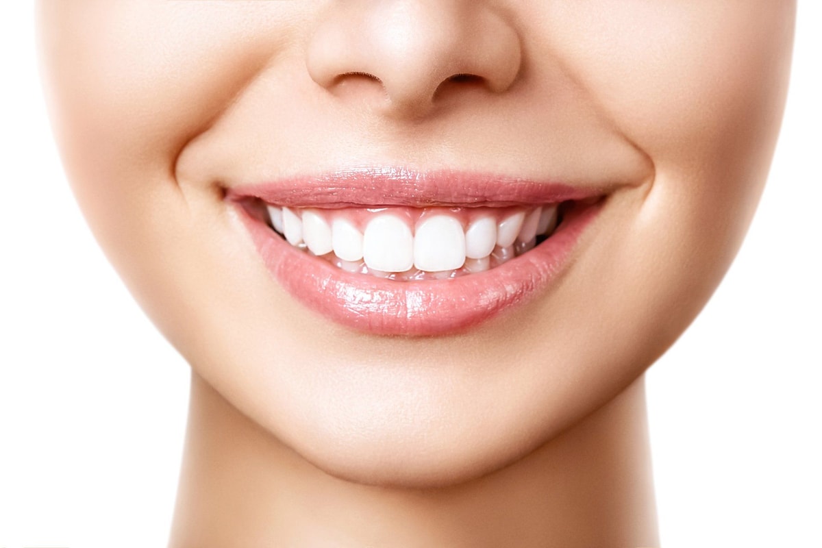 Primo piano di un sorriso con i denti curati